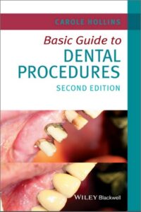Basic Guide to Dental Procedures, 2nd Edition