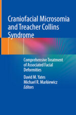 Craniofacial Microsomia and Treacher Collins Syndrome