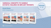Surgical Concepts to Handle Esthetic Failures in Implant Patients