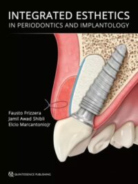Integrated Esthetics in Periodontics and Implantology