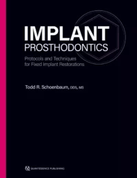 Implant Prosthodontics: Protocols and Techniques for Fixed Implant Restorations
