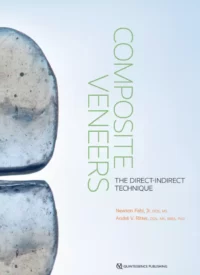 Composite Veneers: The Direct-Indirect Technique (Scanned Copy)
