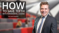 How To Save Teeth With Periodontal Disease