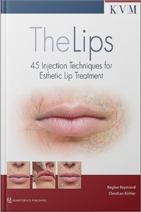 The Lips: 45 Injection Techniques for Esthetic Lip Treatment (Scanned Copy)