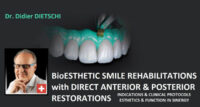BioEsthetic Smile Rehabilitations with Direct Anterior & Posterior Restorations