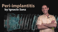 Peri-Implantitis: Prevention and Treatment (Video Course)