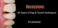 Recessions: All Types of Flap & Tunnel Techniques