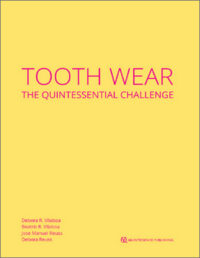 Tooth Wear The Quintessential Challenge (Epub & Converted PDF)