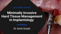 Minimally Invasive Hard Tissue Management in Implantology (2 Lectures)