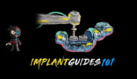 The Implant Guides 101 Course