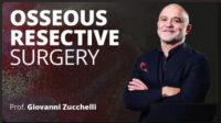 Osseous Resective Surgery