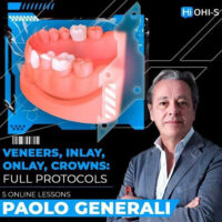 Veneers, Inlay, Onlay, Crowns: Full Protocols