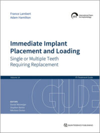Immediate Implant Placement and Loading ( ITI Treatment Guide, Volume 14)