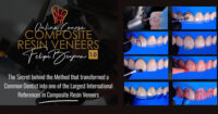 Composite Resin Veneers Course