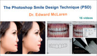 The Photoshop Smile Design Technique (PSD)