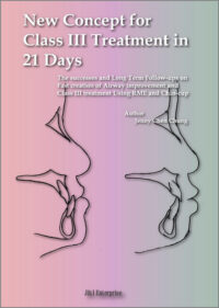 New Concept for Class III Treatment in 21 Days