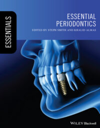 Essential Periodontics