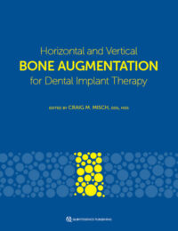 Horizontal and Vertical Bone Augmentation for Dental Implant Therapy