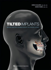 Tilted Implants: Implant-Prosthetic Rehabilitation of the Atrophic Patient (Scanned Copy)