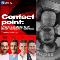 Contact Point: Effective Posterior Teeth Direct Restoration Technique