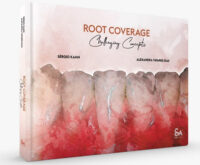 Root Coverage – Challenging Concepts Root Coverage – Challenging Concepts