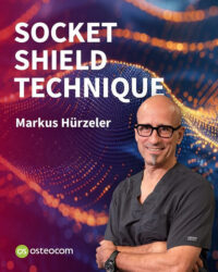 Socket Shield Technique Socket Shield Technique