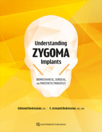Understanding Zygoma Implants: Biomechanical, Surgical, and Prosthetic Principles Understanding Zygoma Implants: Biomechanical, Surgical, and Prosthetic Principles