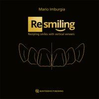 Resmiling: Restyling Smiles with Vertical Veneers (Scanned PDF Copy)