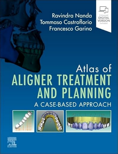 Atlas of Aligner Treatment and Planning: A Case-Based Approach (Epub & Converted PDF Copy)