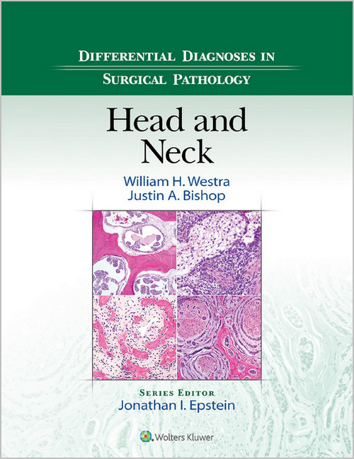 Differential Diagnoses in Surgical Pathology: Head and Neck Differential Diagnoses in Surgical Pathology: Head and Neck