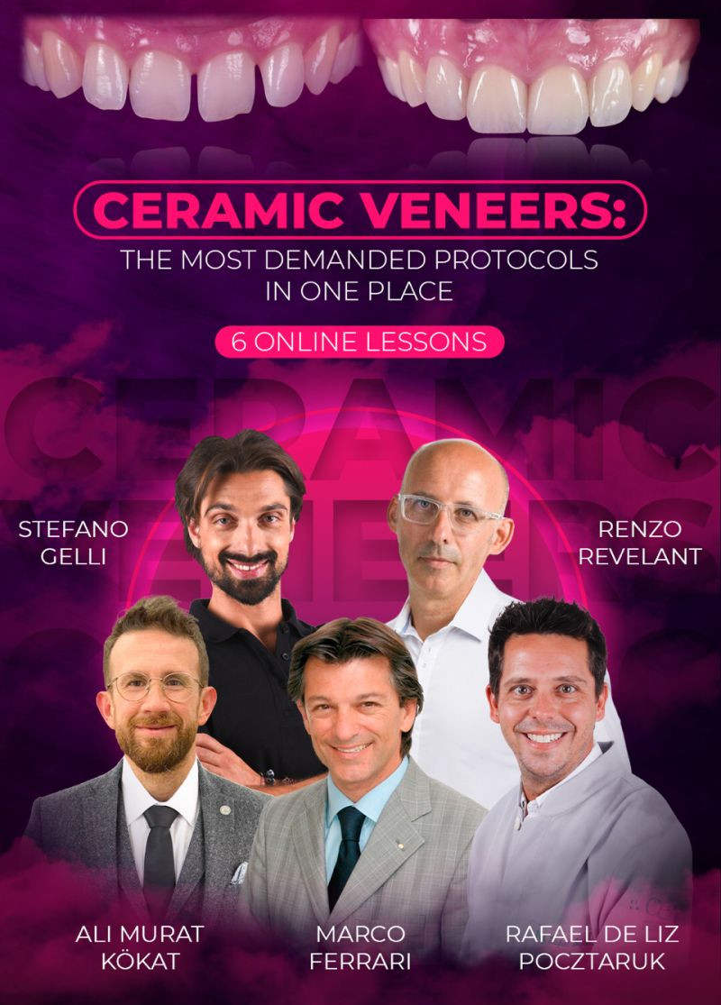 Ceramic Veneers: the Most Demanded Protocols in one Place Ceramic Veneers: the Most Demanded Protocols in one Place
