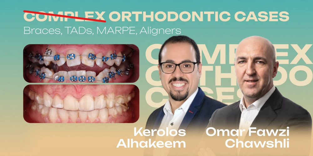 Complex Orthodontic Cases. Braces, TADs, MARPE, Aligners Complex Orthodontic Cases. Braces, TADs, MARPE, Aligners