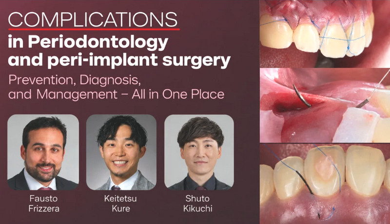 Complications in Periodontology and Peri-implant Surgery Prevention, Diagnosis, and Management – All in One Place Complications in Periodontology and Peri-implant Surgery Prevention, Diagnosis, and Management – All in One Place