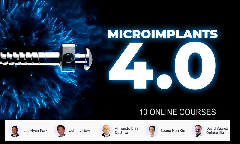Microimplants 4.0 Microimplants 4.0