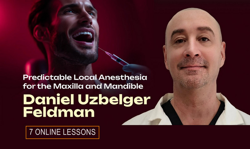 Predictable Local Anesthesia for the Maxilla and Mandible Predictable Local Anesthesia for the Maxilla and Mandible