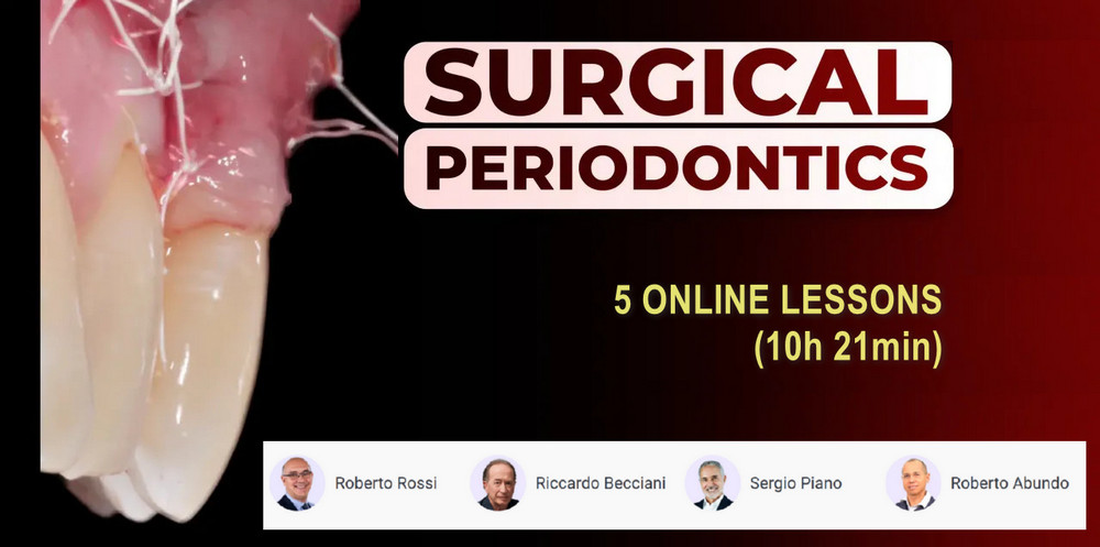 Surgical Periodontics Surgical Periodontics