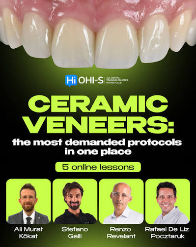 Ceramic Veneers: the Most Demanded Protocols in one Place - Image 2